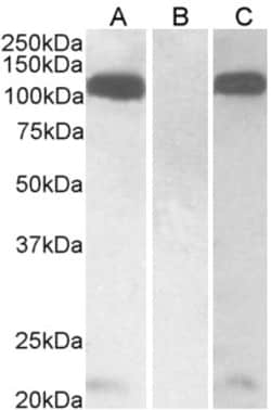 Invitrogen Furin Polyclonal Antibody 100 &mu;g; Unconjugated:Antibodies,
