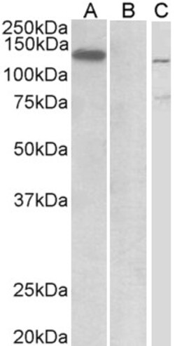 Invitrogen MIB1 Polyclonal Antibody 100 &mu;g; Unconjugated:Antibodies,