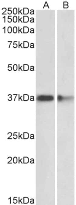 Invitrogen PRMT2 Polyclonal Antibody 100 &mu;g; Unconjugated:Antibodies,