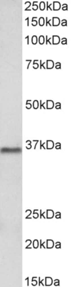 Invitrogen PRMT2 Polyclonal Antibody 100 &mu;g; Unconjugated:Antibodies,