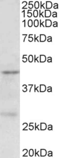 Invitrogen PRMT6 Polyclonal Antibody 100 &mu;g; Unconjugated:Antibodies,