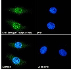 Invitrogen Estrogen Receptor beta Polyclonal Antibody 100 &mu;g; Unconjugated:Antikörper