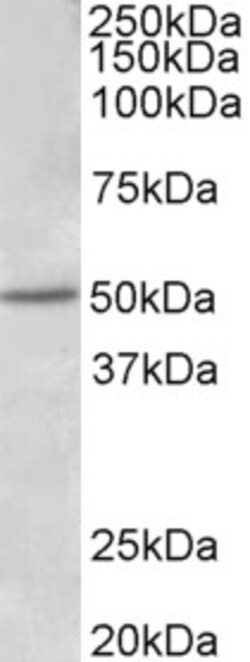 Invitrogen Estrogen Receptor beta Polyclonal Antibody 100 &mu;g; Unconjugated:Antikörper