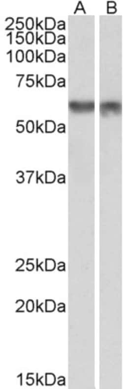 Invitrogen PDCD4 Polyclonal Antibody 100 &mu;g; Unconjugated:Antibodies,