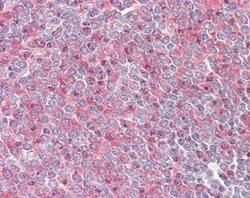 Invitrogen PKC beta Polyclonal Antibody 100 &mu;g; Unconjugated:Antibodies,