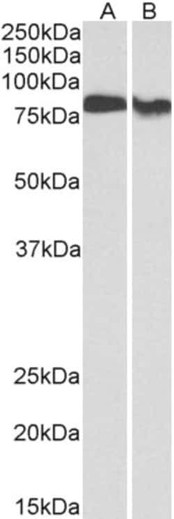 Invitrogen PKC beta Polyclonal Antibody 100 &mu;g; Unconjugated:Antibodies,