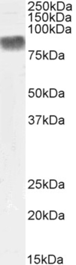 Invitrogen PKC beta Polyclonal Antibody, Biotin 100 μg; Biotin:Antibodies,