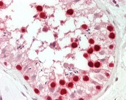 Invitrogen PCNA Polyclonal Antibody 100 &mu;g | Buy Online | Invitrogen&trade; | Fisher Scientific