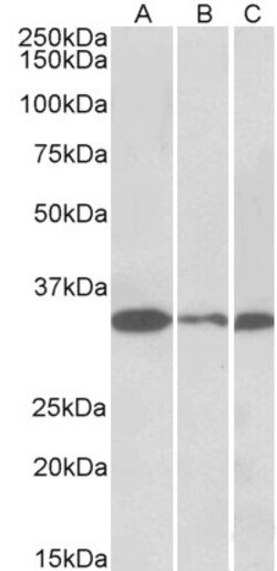 Invitrogen PCNA Polyclonal Antibody 100 &mu;g | Buy Online | Invitrogen&trade; | Fisher Scientific