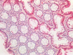 Invitrogen PCNA Polyclonal Antibody 100 μg; Unconjugated:Antibodies,