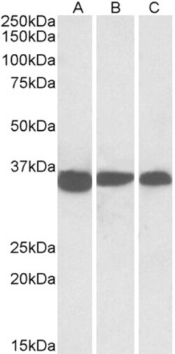 Invitrogen PCNA Polyclonal Antibody 100 μg; Unconjugated:Antibodies,