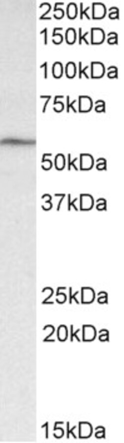 Invitrogen GLP1R Polyclonal Antibody 100 &mu;g; Unconjugated:Antibodies,