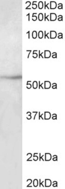 Invitrogen Beta III Tubulin Polyclonal Antibody 100 &mu;g; Unconjugated:Antibodies,