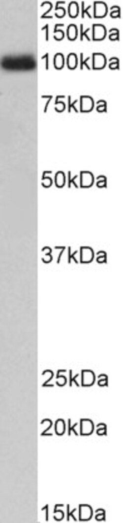 Invitrogen CSF3R Polyclonal Antibody 100 &mu;g; Unconjugated:Antibodies,