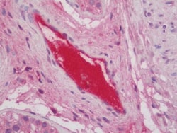 Invitrogen Complement C3 Polyclonal Antibody 100 &mu;g | Buy Online | Invitrogen&trade; | Fisher Scientific