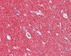 Invitrogen alpha Synuclein Polyclonal Antibody 100 &mu;g; Unconjugated:Antibodies,