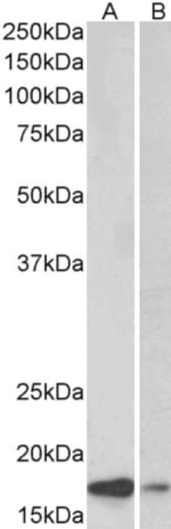 Invitrogen alpha Synuclein Polyclonal Antibody 100 &mu;g; Unconjugated:Antibodies,