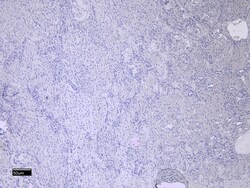 Invitrogen MMP3 Polyclonal Antibody 100 &mu;g; Unconjugated:Antibodies,