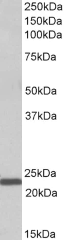 Invitrogen IL-15 Polyclonal Antibody 100 &mu;g; Unconjugated:Antibodies,