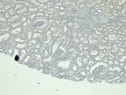 Invitrogen Calbindin D28K Polyclonal Antibody 100 &mu;g | Buy Online | Invitrogen&trade; | Fisher Scientific