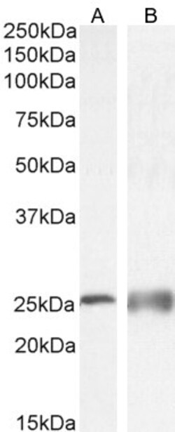 Invitrogen Calbindin D28K Polyclonal Antibody 100 &mu;g | Buy Online | Invitrogen&trade; | Fisher Scientific