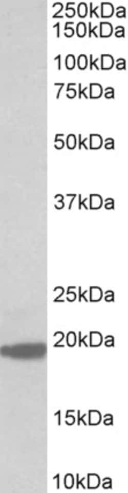 Invitrogen MCTS1 Polyclonal Antibody 100 &mu;g; Unconjugated:Antibodies,
