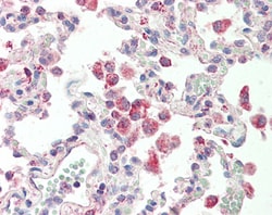Invitrogen GLRA1 Polyclonal Antibody 100 μg; Unconjugated:Antibodies,