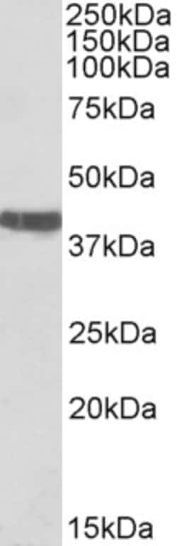 Invitrogen Cardiac Troponin T Polyclonal Antibody 100 μg; Unconjugated:Antibodies,
