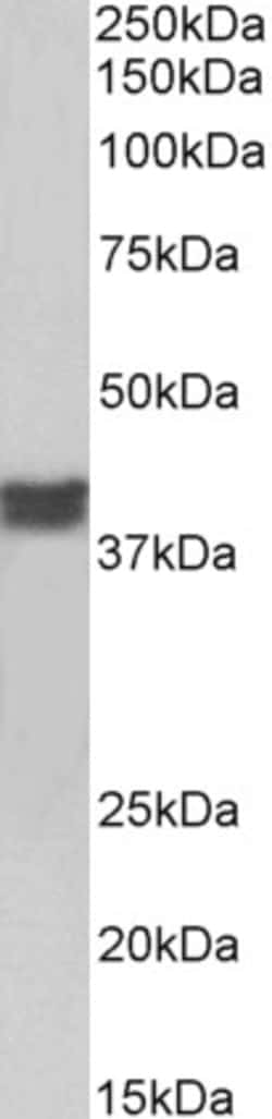 Invitrogen Cardiac Troponin T Polyclonal Antibody 100 μg; Unconjugated:Antibodies,