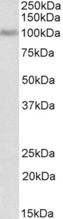 Invitrogen Periostin Polyclonal Antibody 100 &mu;g; Unconjugated:Antibodies,
