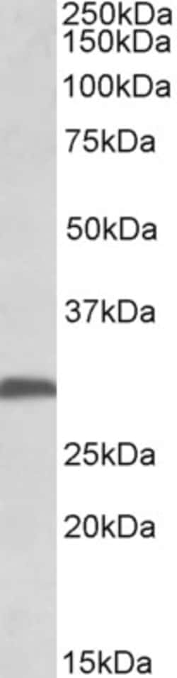 Invitrogen FGF13 Polyclonal Antibody 100 &mu;g | Buy Online | Invitrogen&trade; | Fisher Scientific