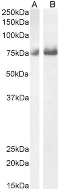 Invitrogen C1orf85 Polyclonal Antibody 100 &mu;g; Unconjugated:Antibodies,
