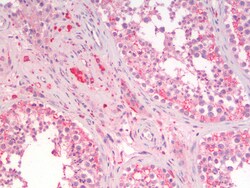 Invitrogen SGTA Polyclonal Antibody 100 μg; Unconjugated:Antibodies,