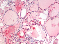 Invitrogen SGTA Polyclonal Antibody 100 μg; Unconjugated:Antibodies,