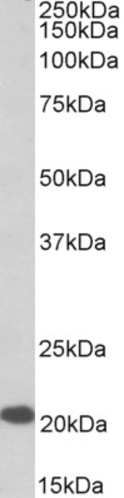 Invitrogen CSP alpha Polyclonal Antibody 100 &mu;g; Unconjugated:Antibodies,
