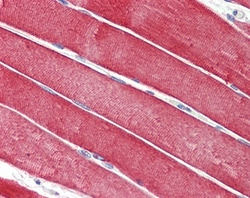 Invitrogen CSP alpha Polyclonal Antibody 100 &mu;g; Unconjugated:Antibodies,