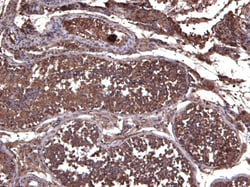 Invitrogen LIF Polyclonal Antibody 100 &mu;g; Unconjugated:Antibodies,