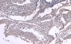 Invitrogen LIF Polyclonal Antibody 100 &mu;g; Unconjugated:Antibodies,