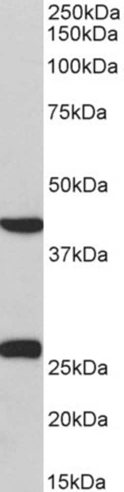 Invitrogen MKP3 Polyclonal Antibody 100 &mu;g; Unconjugated:Antibodies,