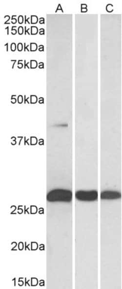 Invitrogen MKP3 Polyclonal Antibody 100 &mu;g; Unconjugated:Antibodies,