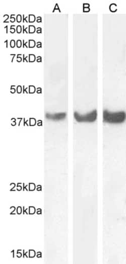 Invitrogen HOXD13 Polyclonal Antibody 100 &mu;g; Unconjugated:Antibodies,