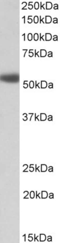 Invitrogen alpha-1a Adrenergic Receptor Polyclonal Antibody 100 &mu;g;