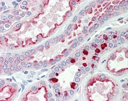 Invitrogen PRAK Polyclonal Antibody 100 &mu;g | Buy Online | Invitrogen&trade; | Fisher Scientific