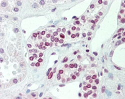 Invitrogen PRAK Polyclonal Antibody 100 μg; Unconjugated:Antibodies,
