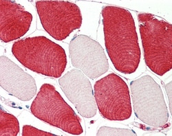 Invitrogen MIA Polyclonal Antibody 100 &mu;g; Unconjugated:Antibodies,