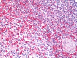 Invitrogen MIA Polyclonal Antibody 100 &mu;g; Unconjugated:Antibodies,
