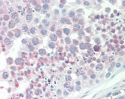 Invitrogen IGFBP-1 Polyclonal Antibody 100 &mu;g; Unconjugated:Antibodies,