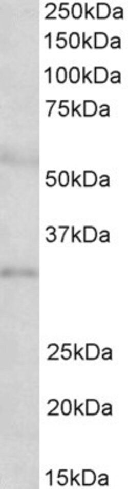 Invitrogen IGFBP-1 Polyclonal Antibody 100 &mu;g; Unconjugated:Antibodies,