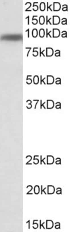 Invitrogen Transferrin Receptor Polyclonal Antibody 100 &mu;g; Unconjugated:Antibodies,
