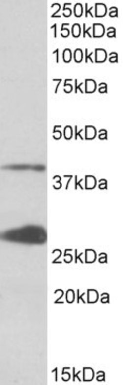 Invitrogen UROD Polyclonal Antibody 100 &mu;g; Unconjugated:Antibodies,